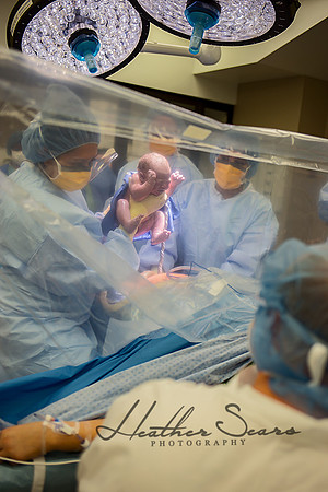 Hospital Birth Photography KC | C-Section Delivery Coverage