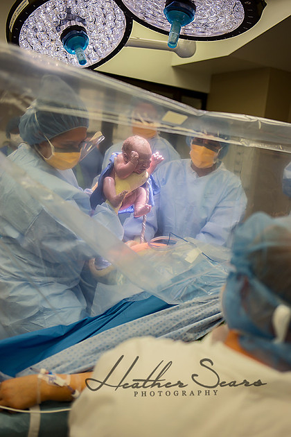 Hospital Birth Photography KC | C-Section Delivery Coverage