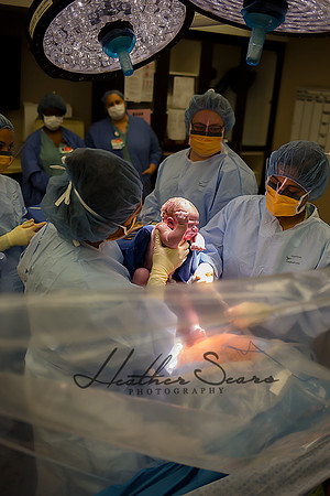 Hospital Birth Photography KC | C-Section Delivery Coverage