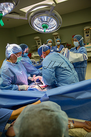 Hospital Birth Photography KC | C-Section Delivery Coverage