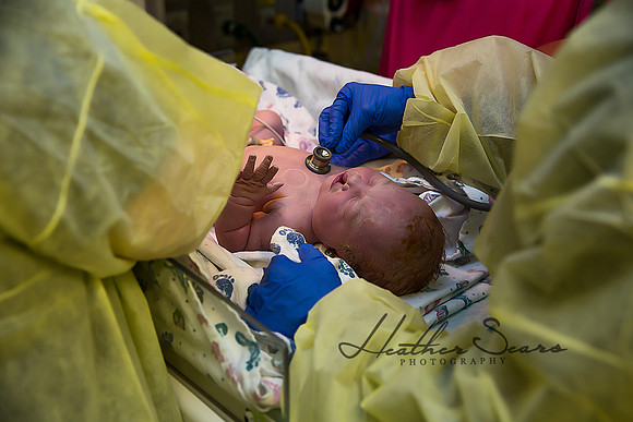 Hospital Birth Photography KC | C-Section Delivery Coverage