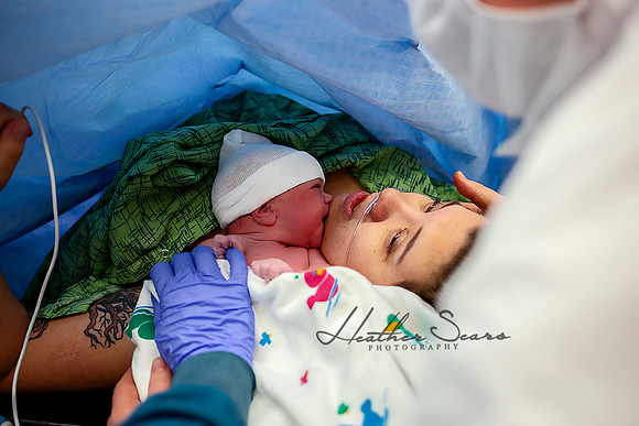 Hospital Birth Photography KC | C-Section Delivery Coverage