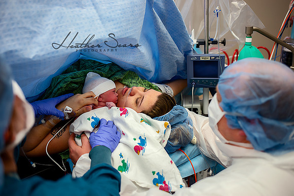 Hospital Birth Photography KC | C-Section Delivery Coverage