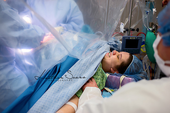 Hospital Birth Photography KC | C-Section Delivery Coverage