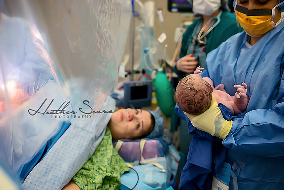 Hospital Birth Photography KC | C-Section Delivery Coverage