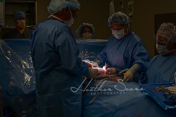 Hospital Birth Photography KC | C-Section Delivery Coverage