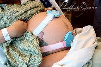 Hospital Birth Photography KC | C-Section Delivery Coverage