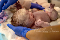 Hospital Birth Photography KC | C-Section Delivery Coverage