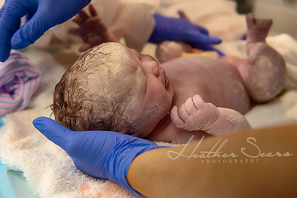 Hospital Birth Photography KC | C-Section Delivery Coverage