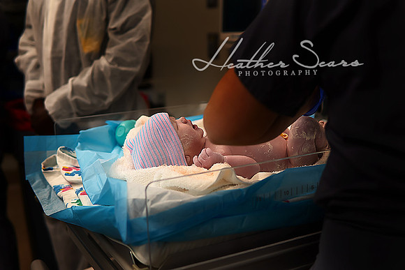 Hospital Birth Photography KC | C-Section Delivery Coverage