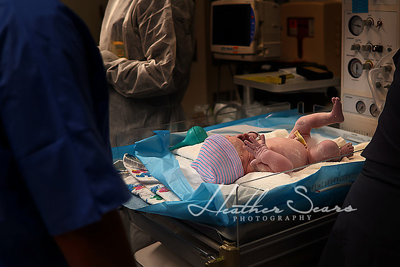 Hospital Birth Photography KC | C-Section Delivery Coverage