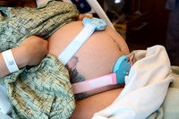 Hospital Birth Photography KC | C-Section Delivery Coverage