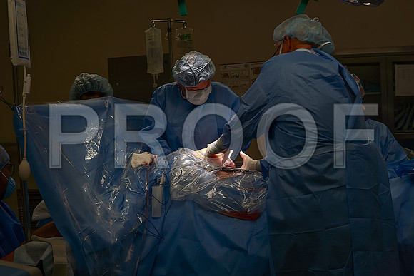 Hospital Birth Photography KC | C-Section Delivery Coverage